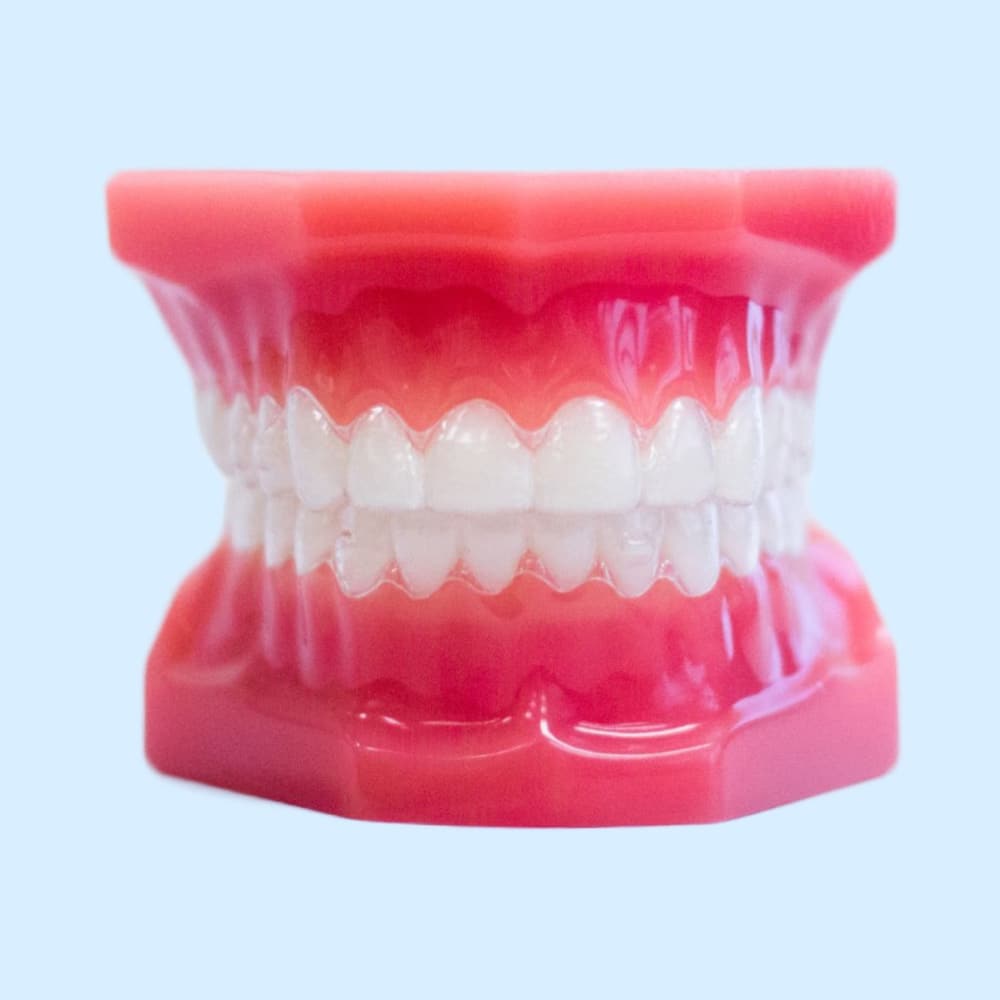 clear aligners on plastic model