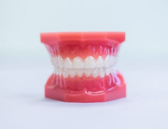 Clear aligner tray held between fingers
